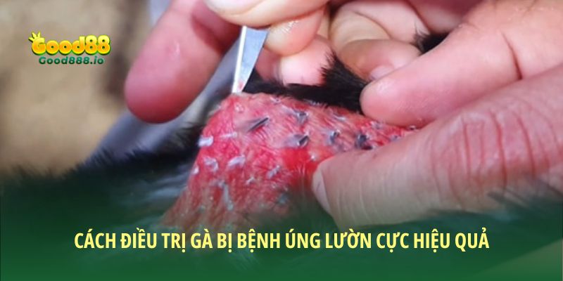 Các cách điều trị cực hiệu quả cho lườn